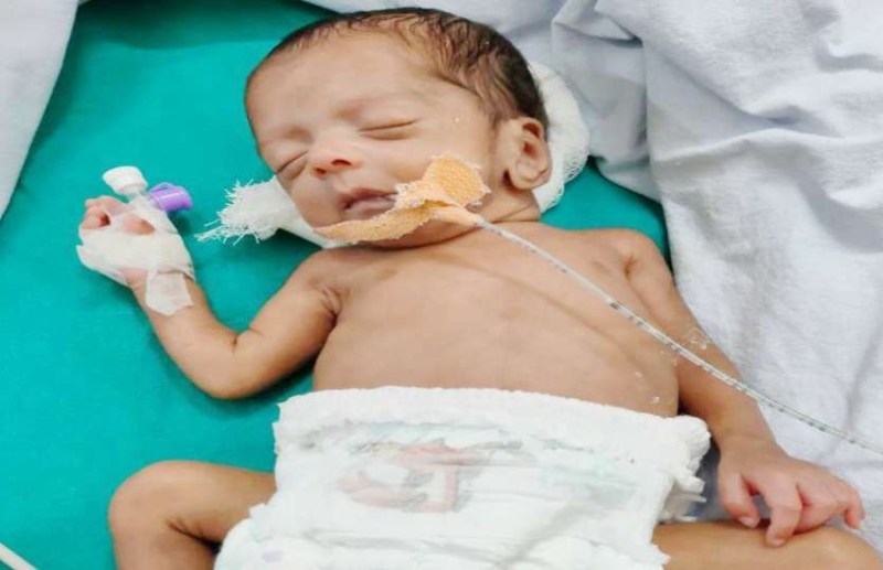 24 हफ्ते में पैदा हुआ अद्भुत बच्चा,डॉक्टर भी हुए हैरान,वजन 1430 ग्राम