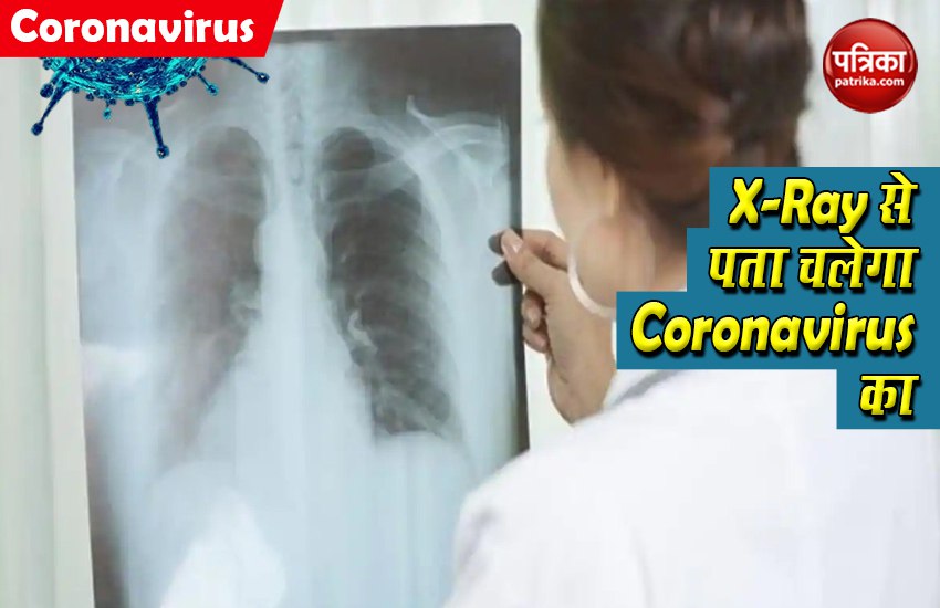छाती के X-Ray से लगाया जाएगा Coronavirus का पता, रिसर्च में किया गया अनोखा दावा