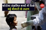 coronavirus kawasaki symptoms seen in children infected with covid-19