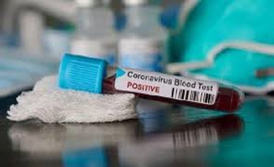 Coronavirus Cases Rajasthan, New Corona positive cases