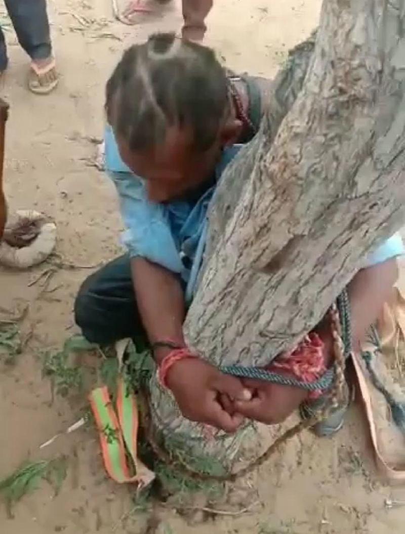 Why did the young man get urine and head shaved