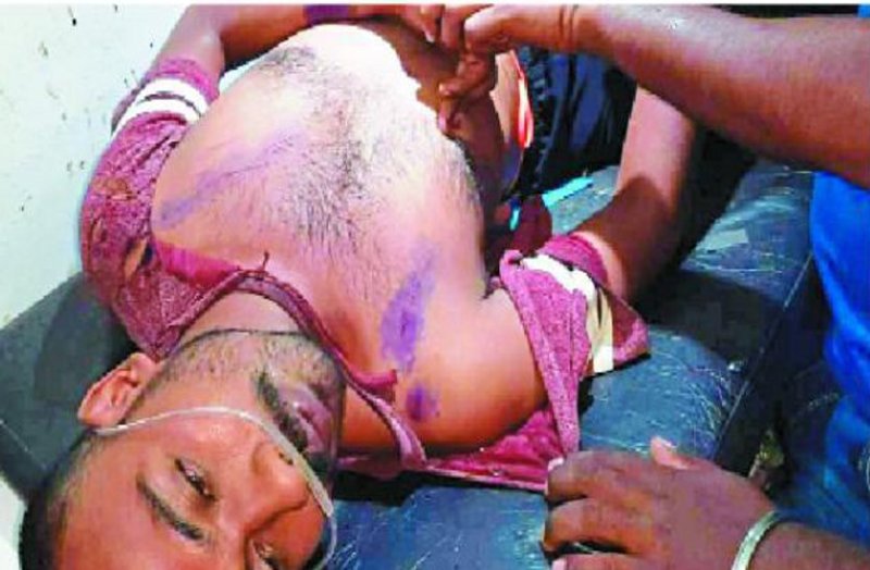 यूथ कांग्रेस अध्यक्ष पर धारदार हथियार से जानलेवा हमला, अंधेरे का फायदा उठाकर भाग खड़े हुए दो नकाबपोश