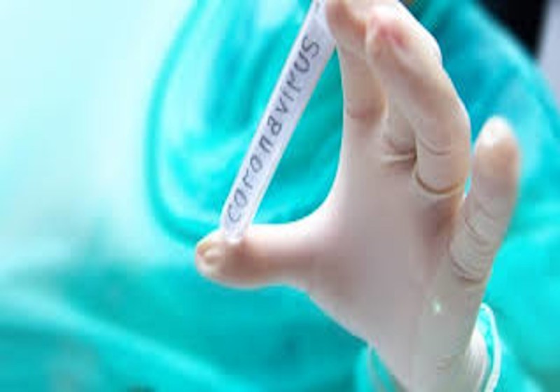 UP Top 10 News: फाइव स्टार होटल में इलाज करा सकेंगे संक्रमित, खुद उठाना होगा खर्च