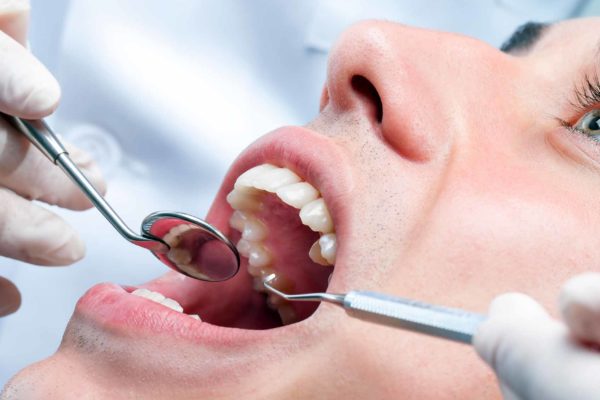 Oral disease
