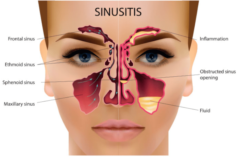 हाथ व पैरों की अंगुलियों पर प्रेशर से साइनस की समस्या में मिलेगी राहत