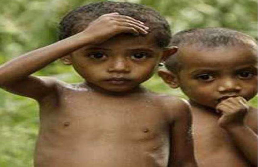 malnourished children