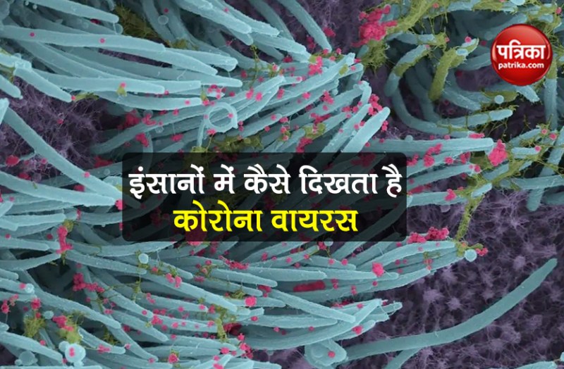 Coronavirus covid-19-infected-cells images out in human body