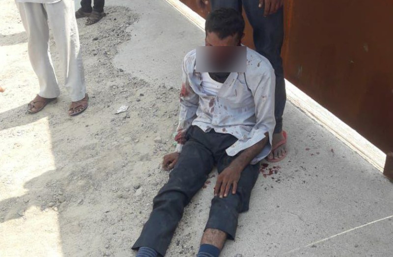 teacher nose cut in barmer