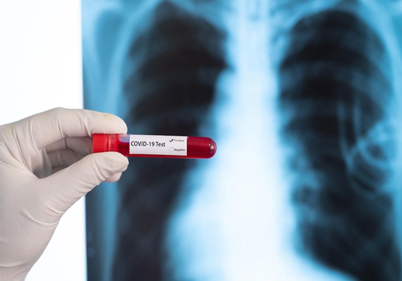 काबू में आ रहा कोरोना वायरस, रिकवरी रेट में हो रहा सुधार, 1.56 लोगों की जांच में सिर्फ 2.8 फीसदी संक्रमित