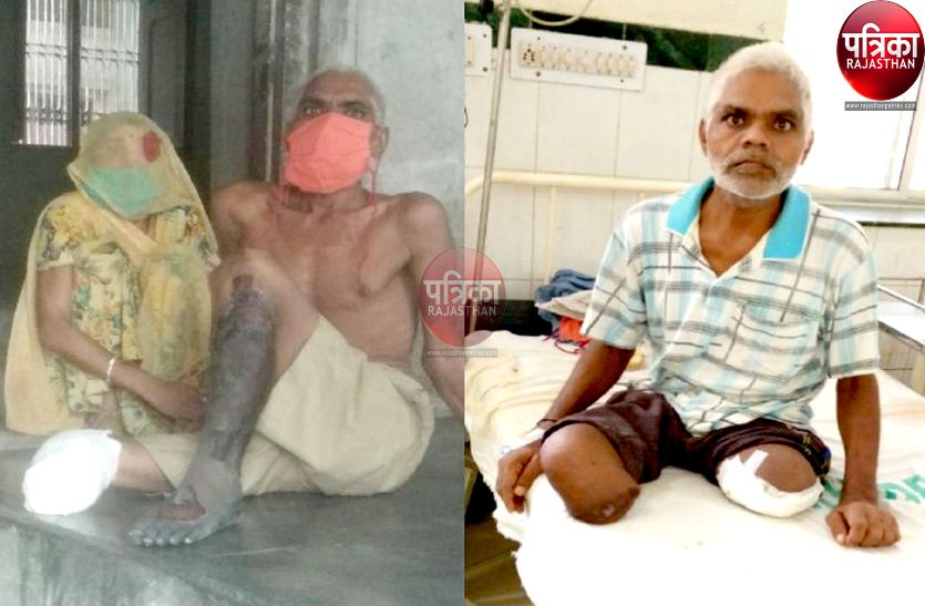 जिन पैरों के दम पर चल रही थी जिंदगी, उन्होंने मझधार में छोड़ दिया साथ