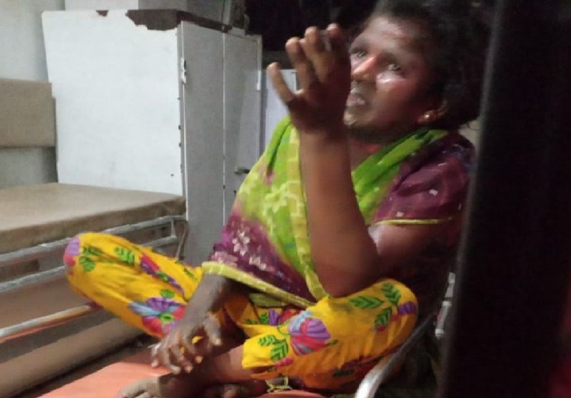 दोस्त संग मिलकर प्रेमी ने प्रेमिका को जलाया जिंदा, गंभीर हालत में लखनऊ रेफर