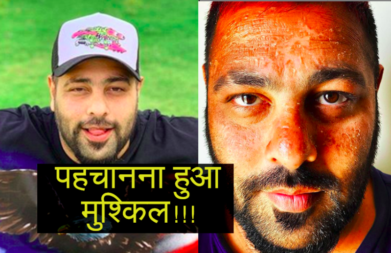 मालदीव में छुट्टियां मना रहे Badshah के चेहरे का हुआ बुरा हाल, फोटो देख फैंस और सेलेब्स हुए चिंतिंत