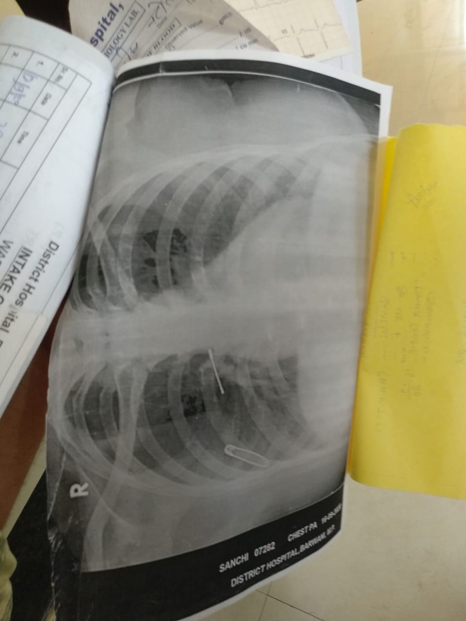 X-ray report 