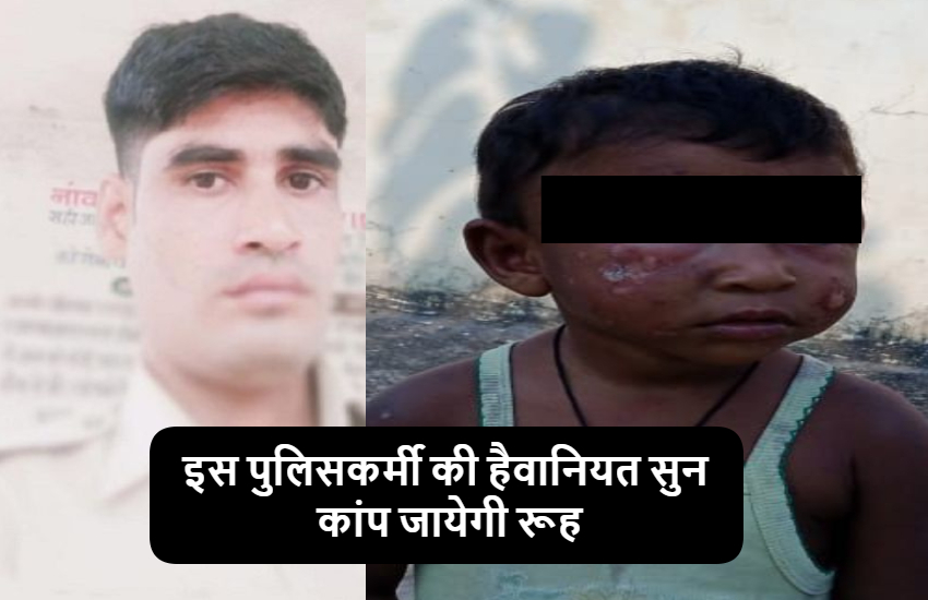 मकान मालकिन की डेढ़ साल की बेटी ने पापा नहीं कहा तो आरक्षक बन गया हैवान, 20 बार सिगरेट से जलाया