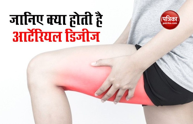 अगर कूल्हे, जांघ या पिंडलियों में होता है तेज दर्द तो हो सकती ये बीमारी