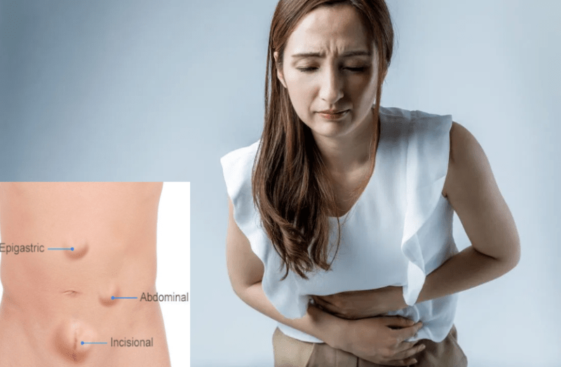 जानिए क्या होता है हर्निया, क्या हैं इसके लक्षण और उपचार