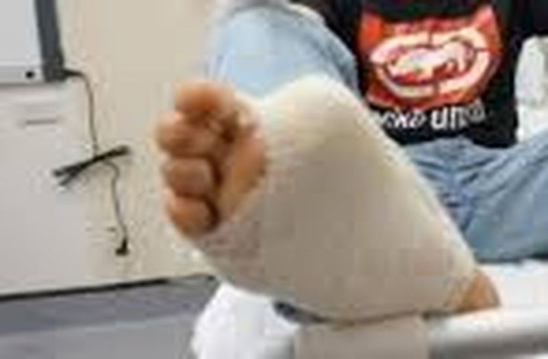 पैर से कटकर अलग हुए अंगूठे को जोड़ा