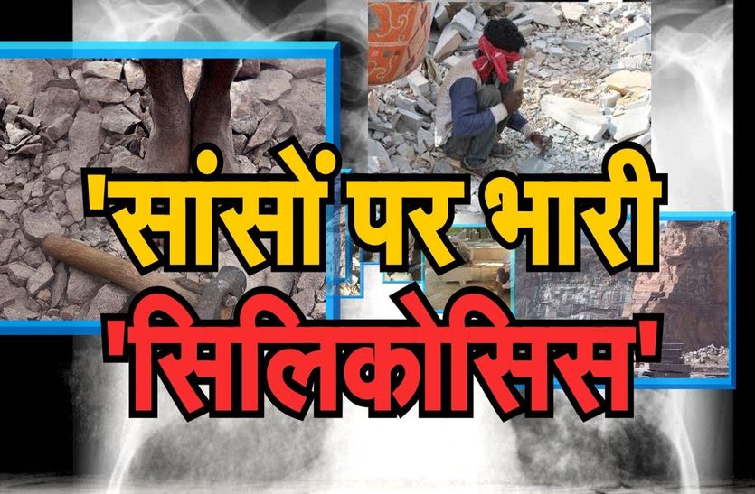 60 percent of silicosis victims are not getting pension in bhilwara