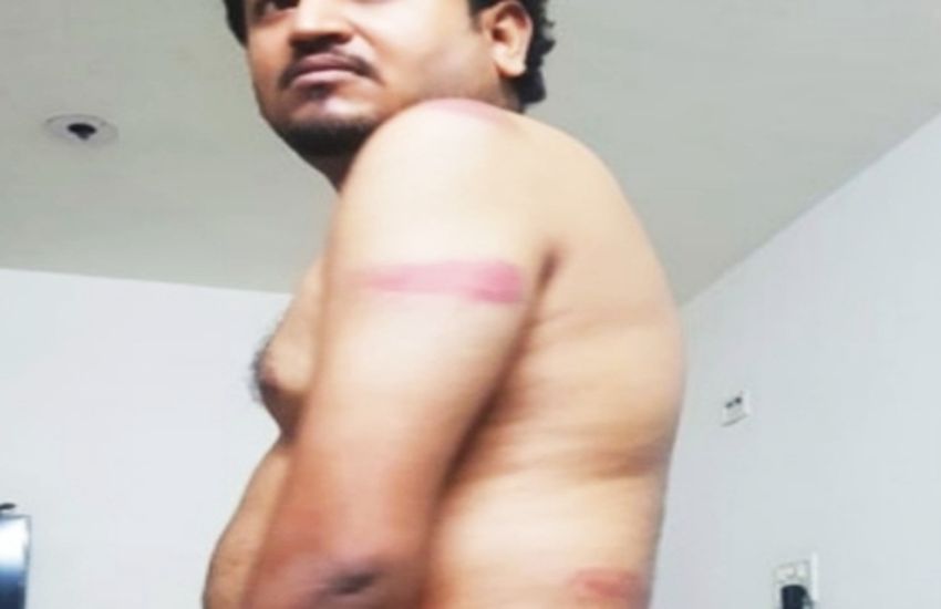brutality : मास्क के लिए बेरहमी से पीटा, शरीर पड़े कई निशान