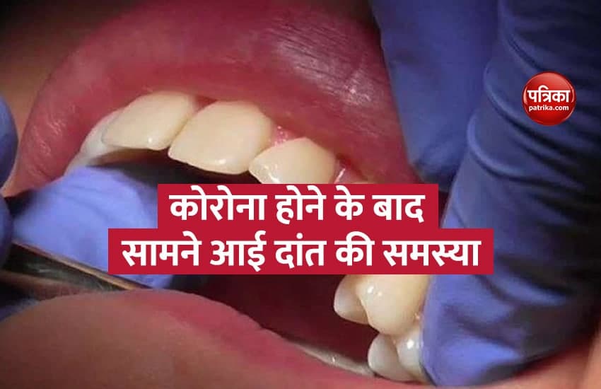 coronavirus bad effect on teeth