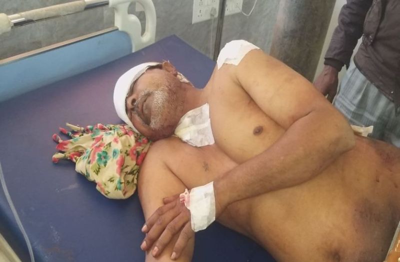 टैंट की दरी चुराते नशेड़ी को टोकना पड़ा भारी, कैंची से हमले में पुत्र की मौत,पिता गंभीर घायल