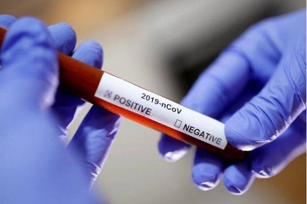coronavirus