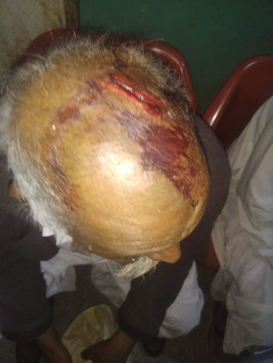 लोहे के पाइप व सरियों से जानलेवा हमला, पिता-पुत्र सहित तीन घायल