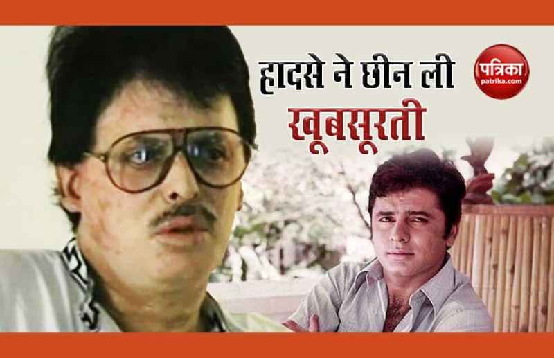 Actor Sanjay Khan Was Burnt In Fire