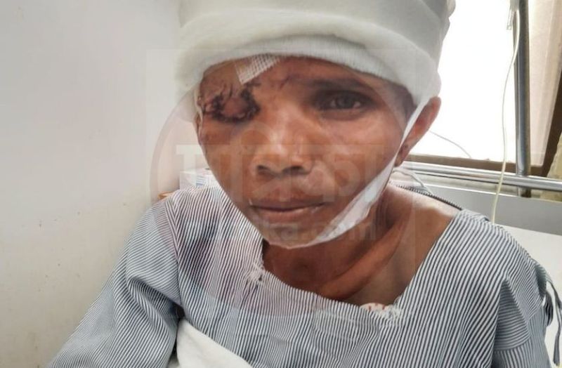 भालू के हमले में गम्भीर घायल महिला की चार घंटे ऑपरेशन के बाद बची जान