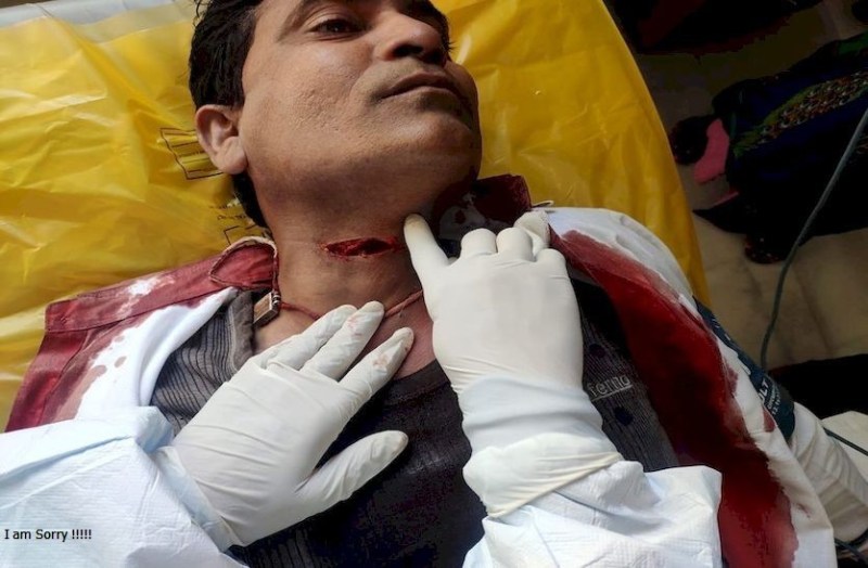 आफत बना पतंग मांझा, गले में मांझा फंसने से बाइक चालक घायल