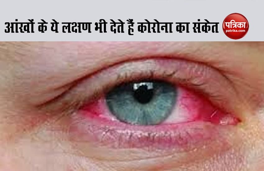 coronavirus pink eye symptoms