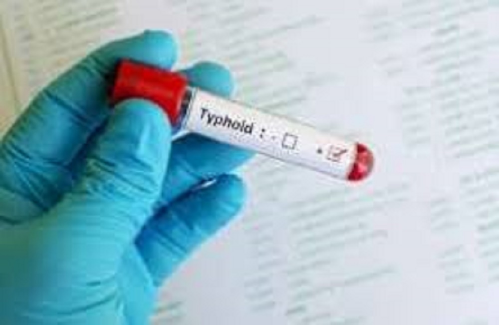 typhoid cases in Chennai increase after rain