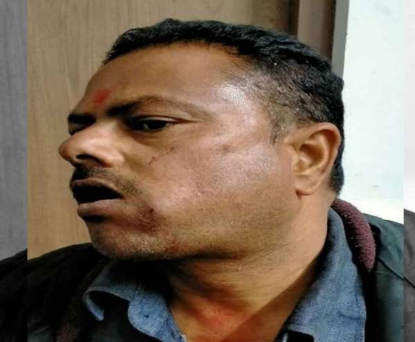 Bullets fired in film style, one killed, two injured