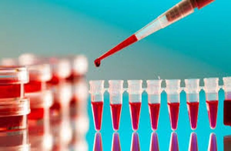 लैब कार्मिकों का पंजीयन अनिवार्य, नहीं मिला तो जांच कार्य माना जाएगा अवैध