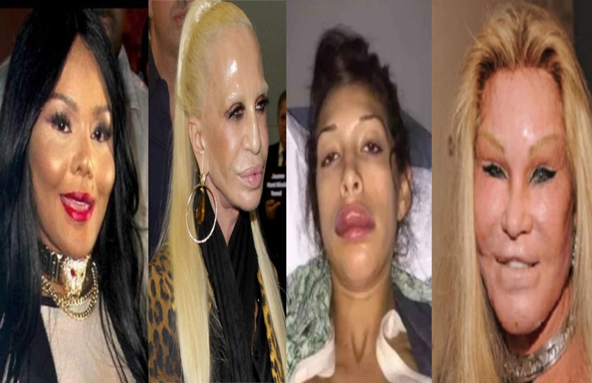 actresses looks ugly after plastic surgery