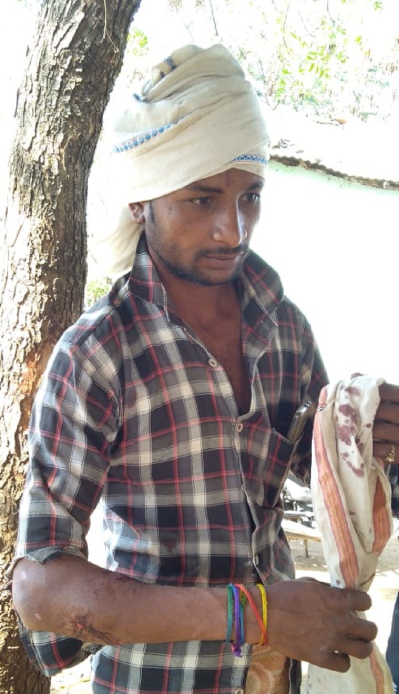 Bear attacked by young man in forest