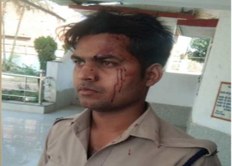 एक और आरक्षक की पिटाई, पहले कुत्ते को घर के सामने शौच कराया, मना किया तो युवकों ने फोड़ा सिर