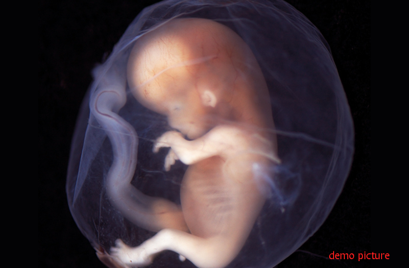 अनोखी उपलब्धि- हाथ की त्वचा की कोशिकाओं से मानव भ्रूण विकसित