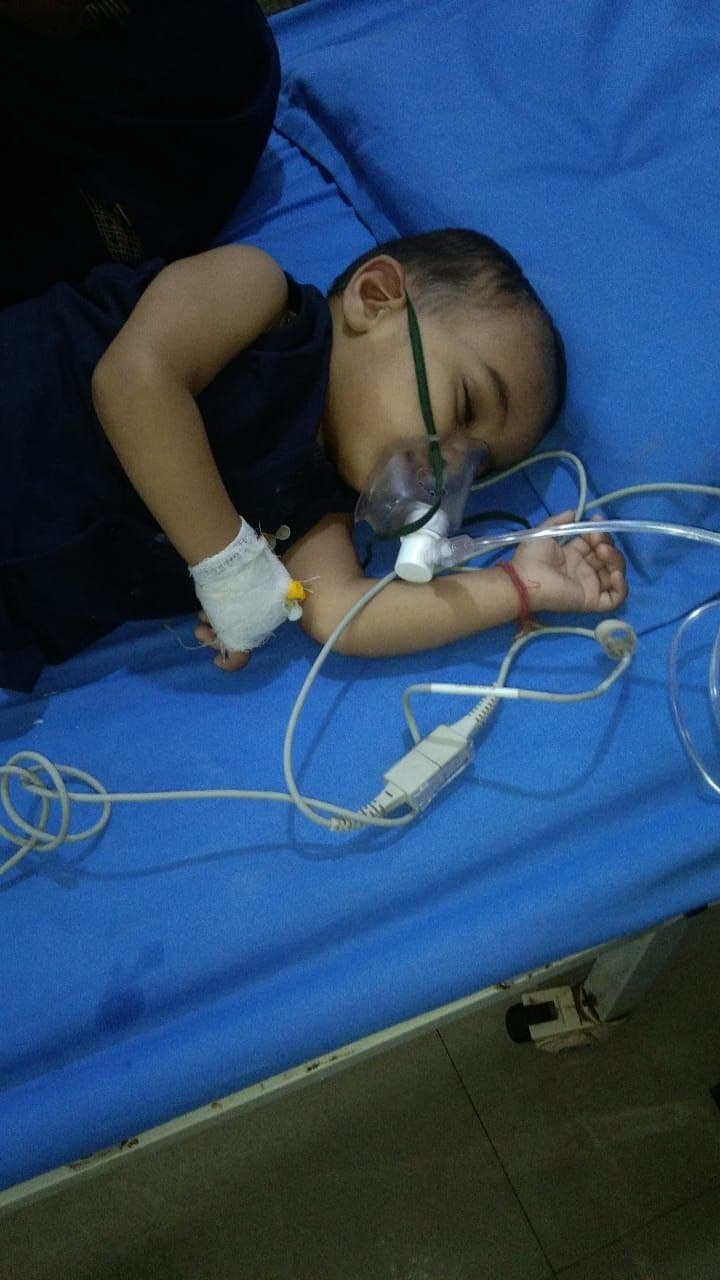 डेढ़ साल के बच्चे के गले में फंसा लोहे का बायशर, ऑपरेशन कर निकाला