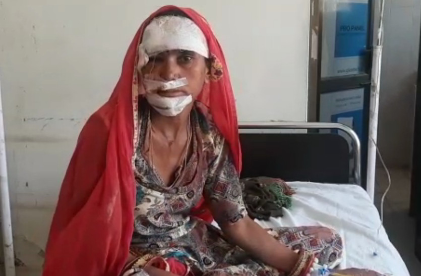 robbers broke golden nostrils woman's nose in kishangarh ajmer