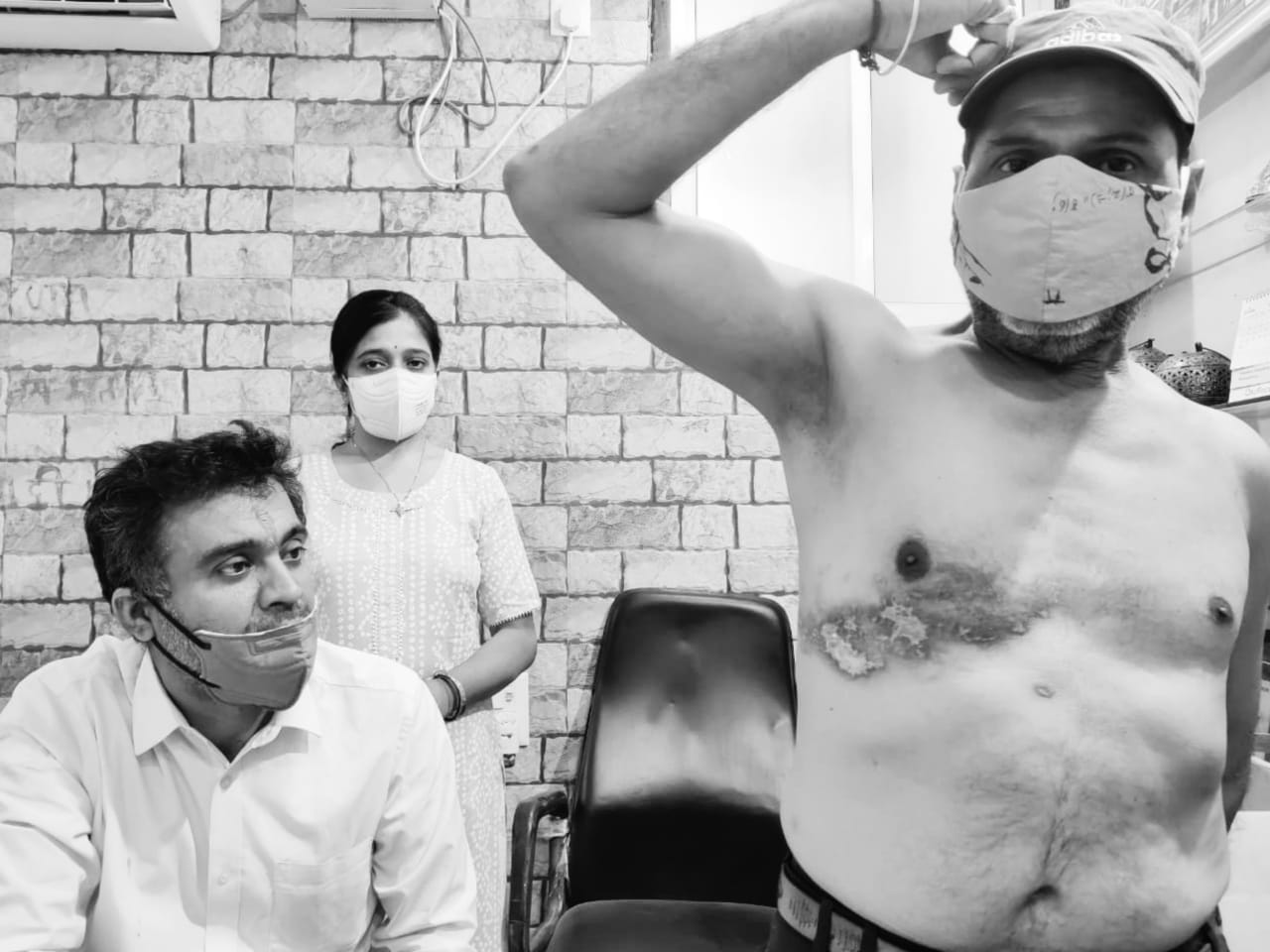 हरपीज जोस्टर - शरीर के आधे हिस्से बीमारी, तेज बुखार जलन और दर्द होता है, जाने इलाज