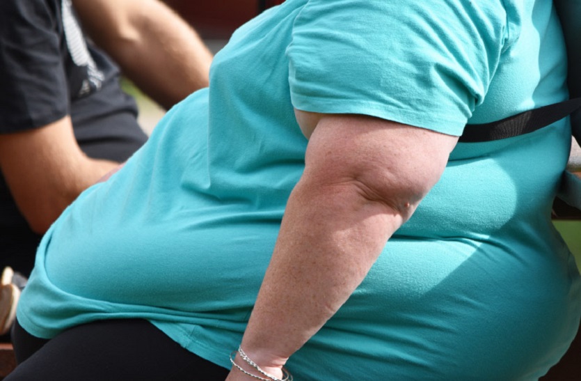 बीमारियों से भी होता 6 प्रकार का मोटापा, ऐसे समझें अंतर