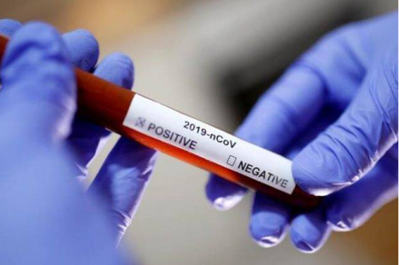 coronavirus