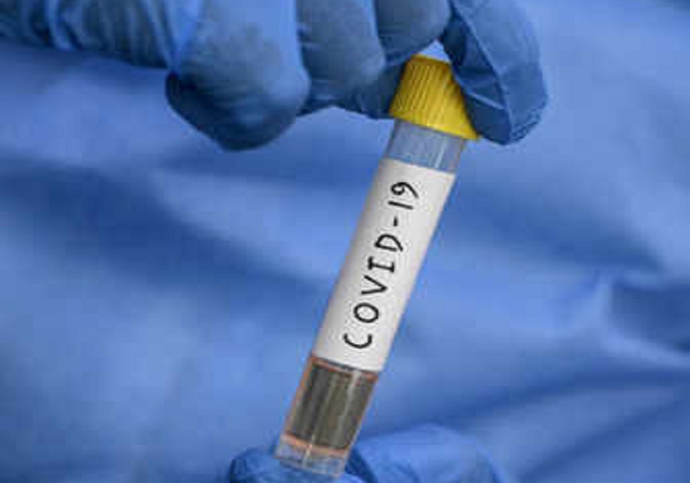 यूपी में कोरोना वायरस संक्रमण से 103 की मौत, लखनऊ में 35 ने जान गंवाई