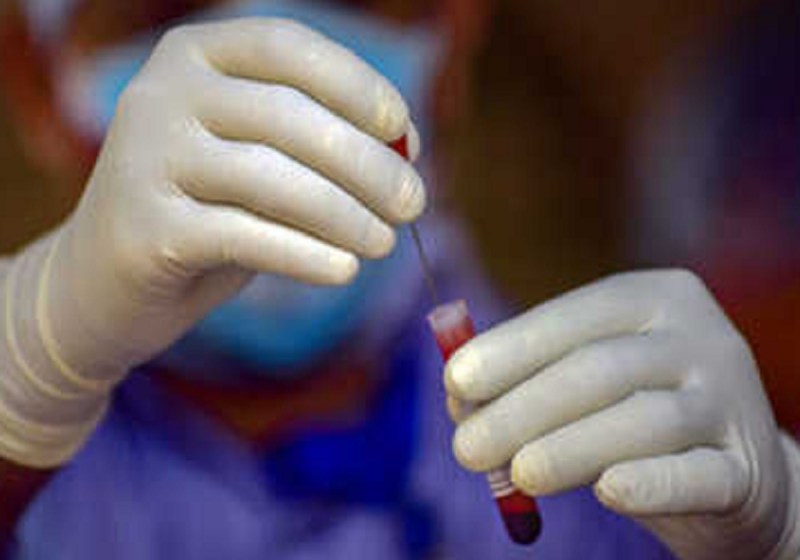 कोरोना वायरस से यूपी के इन चार शहरों के हालत बेहद खराब : स्वास्थ्य मंत्री जय प्रताप सिंह