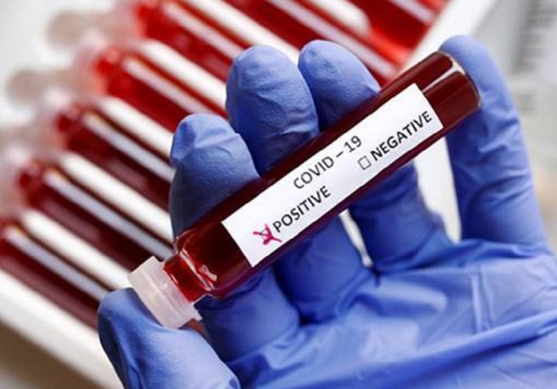 यूपी में कोरोना वायरस से 129 और लखनऊ में 22 लोगों की मौत