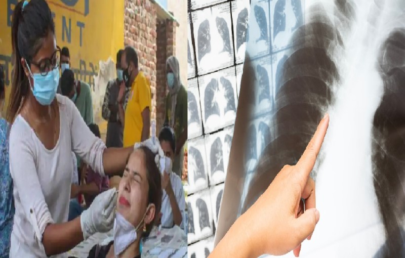 कोरोना के लक्षण तो हैं लेकिन RT-PCR टेस्ट में नहीं हो रही पुष्टि, तो तुरंत कराएं CT स्कैन या X-Ray, जानें डाक्टर की क्या है सलाह