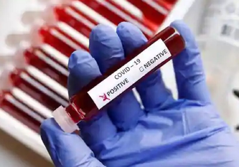 कोरोना वायरस अपडेट : यूपी में इस वक्त करीब ढाई लाख एक्टिव केस