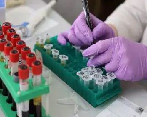 Coronavirus patients reduce after imposed curfew
