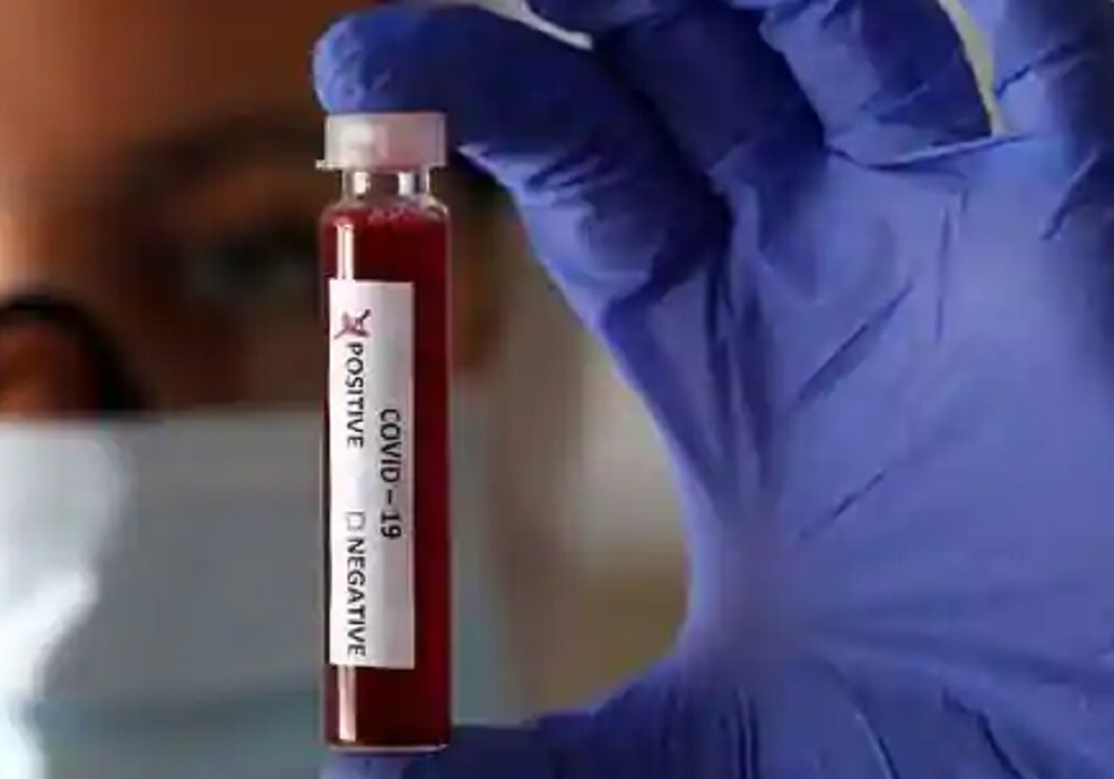 यूपी में बीते 24 घंटे में शनिवार को 332 कोरोना वायरस पाजिटिव की मौत, एक दिन में मरने वालों की यह सबसे बड़ी संख्या